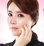 韩国隆鼻手术方法